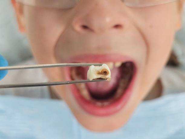 Best Tooth Pain Emergency Relief  in Bunker Hill, OR