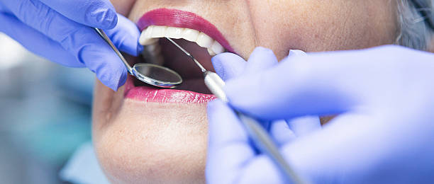 Best Urgent Tooth Repair  in Bunker Hill, OR